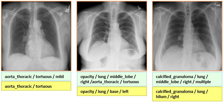 Labeling Chest X-rays with GPUs