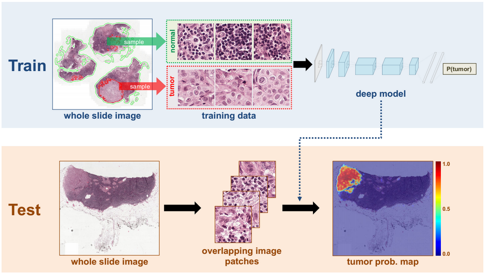DL Breast Cancer Detection Image