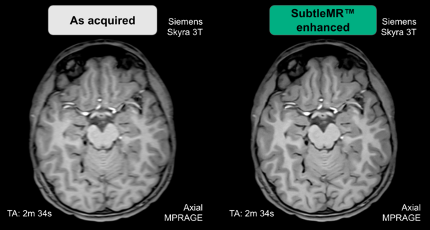 SubtlePET 2.0 Gets CE Mark • APPLIED RADIOLOGY