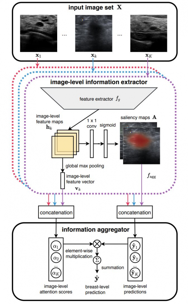 How artificial intelligence is being used to detect breast cancer