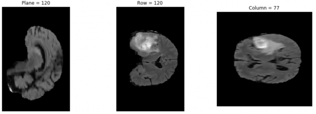 The images show three separate slices of the brain and the tumor. These images are included in the dataset accompanying the Jupyter Notebook.