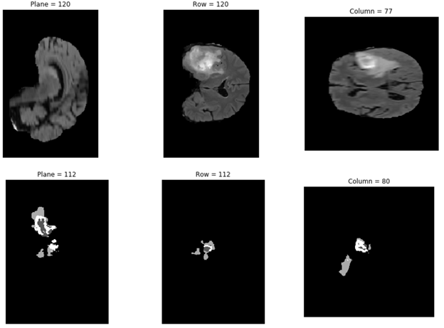 The images show a comparison between the actual images in the data set and the resulting images predicted by the model. The output images from the models show the location and size of the tumor in white color.