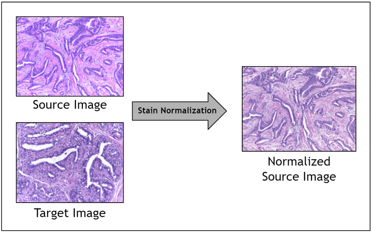 The stain normalization filter accepts a source image and a target image and returns a normalized source image.