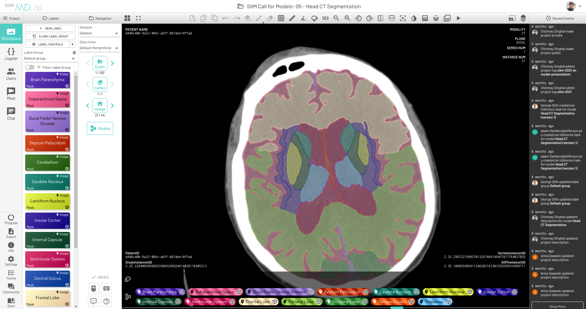 User interface of MD.ai displaying outputs from a brain segmentation model deployed on the platform.