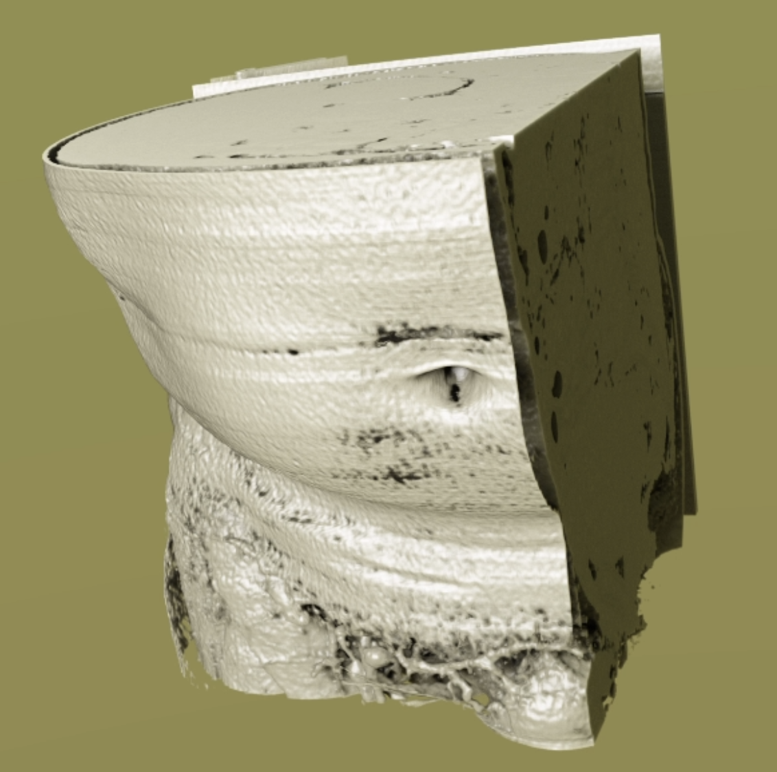 A visual example of a rendered 3D image of the abdomen using the 3D image processing pipeline with cropping using shared memory.