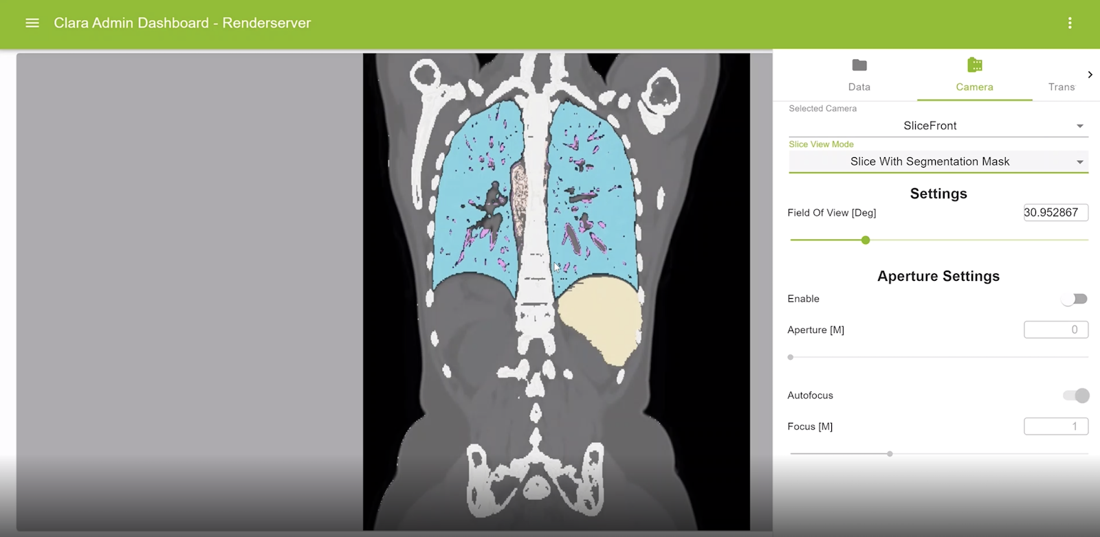 Visual example of using segmentation masks on original slices in the Clara dashboard.