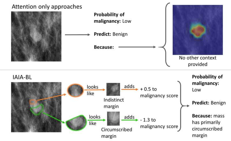 Top image shows an AI model for spotting pre-cancerous lesions in mammography without revealing the decision-making process. Bottom image shows the IAIA-BL model that tells doctors where it's looking and how its drawing its conclusions.