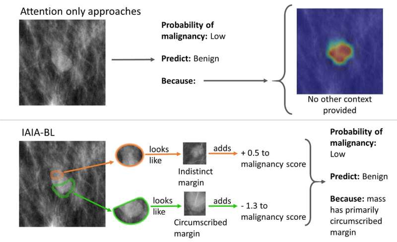 Improving Breast Cancer Detection in Ultrasound Imaging Using AI