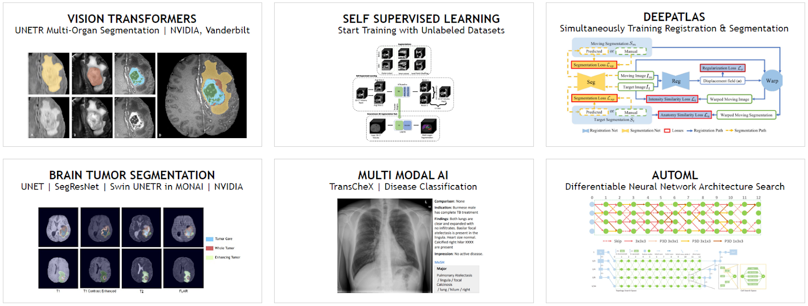 Screenshots of research pipelines on MONAI, such as Brain Tumor Segmentation, DeepAtlas, Vision Transformers and Multi Modal AI for Disease Classification.