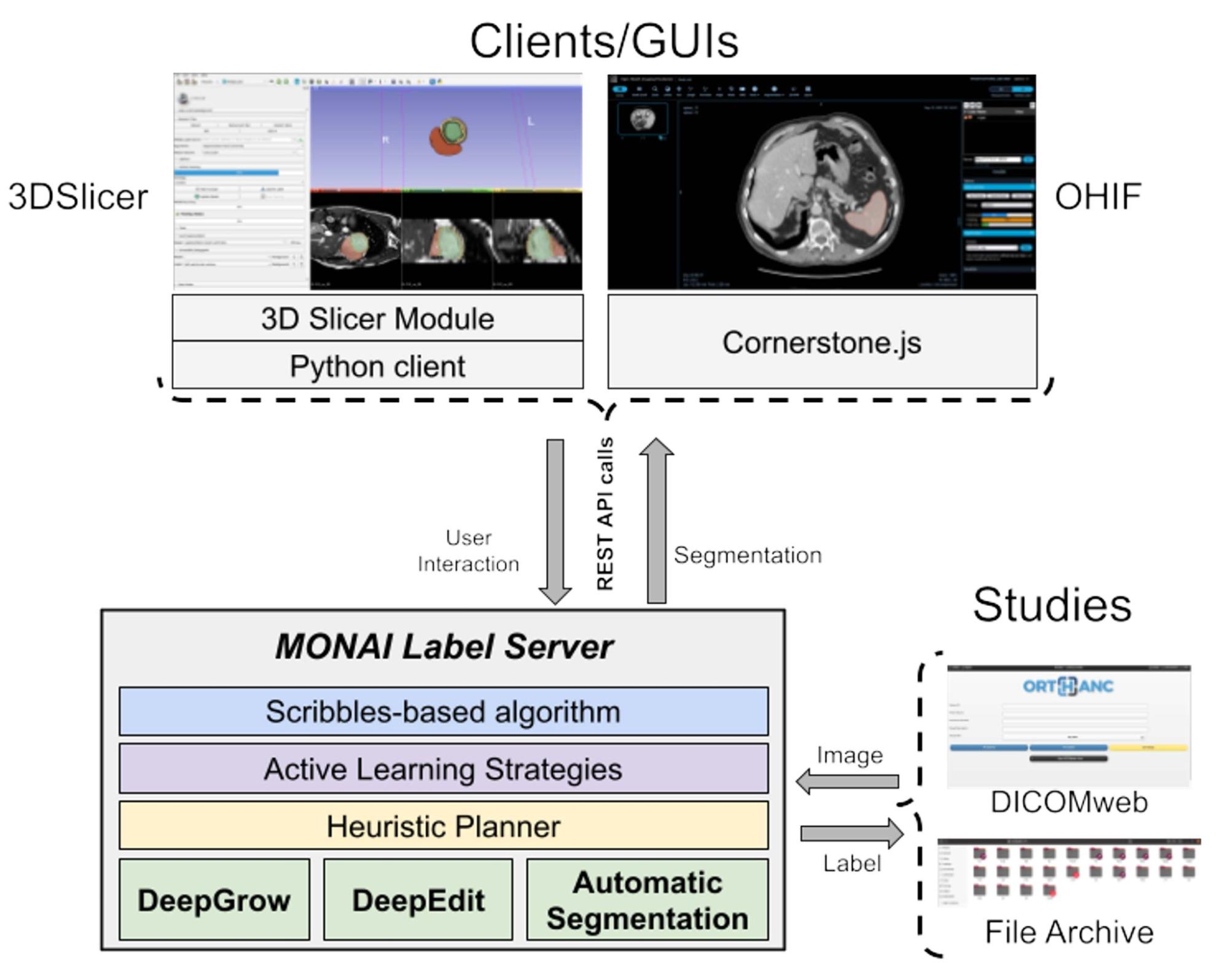MONAI Label bridges the researchers world with clinical collaborators and can be integrated into any viewer, including 3D slicer and OHIF