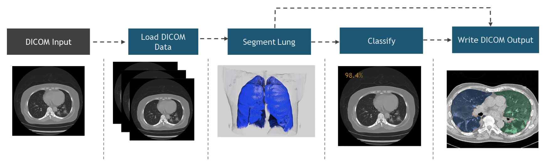 Diagram showing the medical imaging workflow starting with DICOM input and through the Load DICOM data, Segment lung, and Classify steps, and ending with Write DICOM output.

