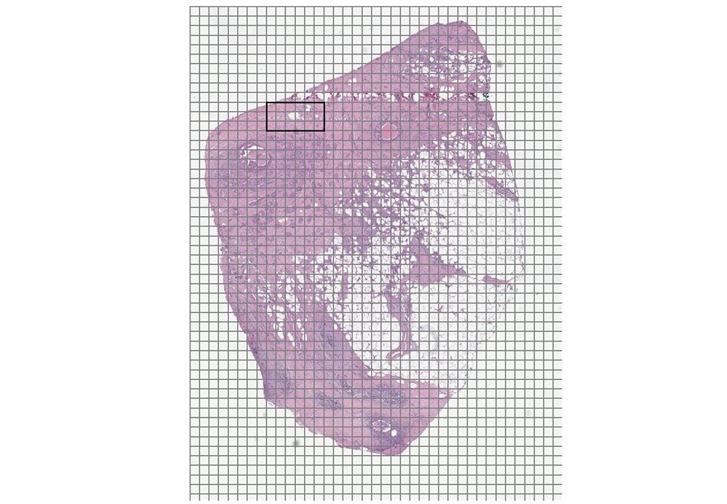 A zoomed-out view of an H&E stained digital pathology slide with region of interest highlighted in black. Grid lines corresponding to the individual TIFF tile boundaries are overlaid in gray.