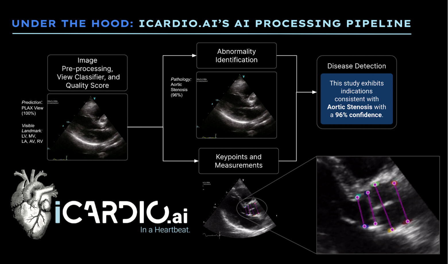 A diagram of the iCardio AI processing pipeline showing flow from image preprocessing to abnormality identification and measurements to output of disease detection.