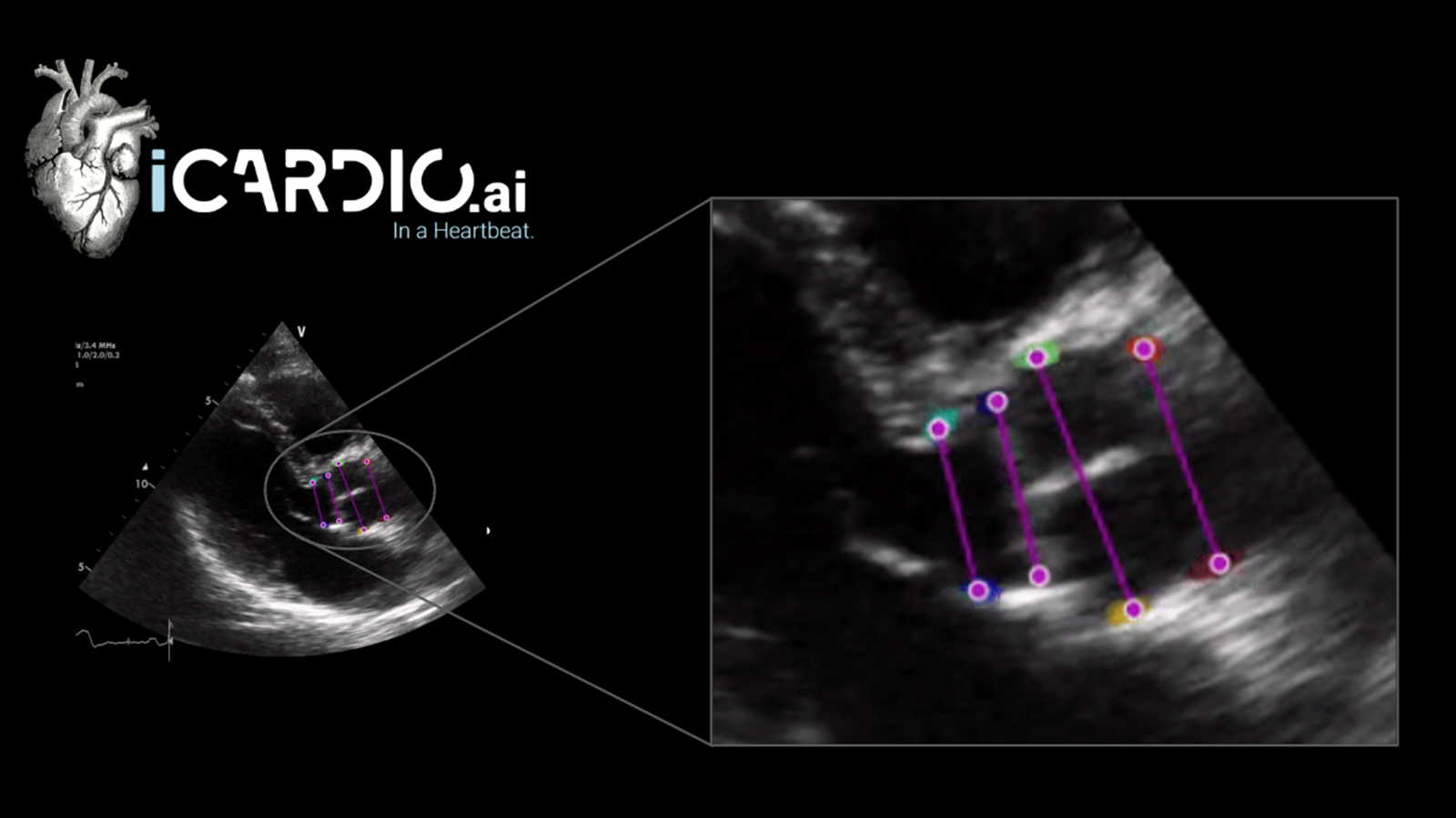 iCardio ultrasound image