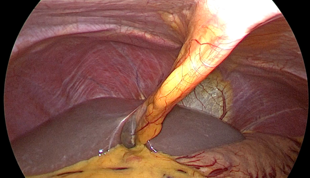 Image of inner organs from video stream.