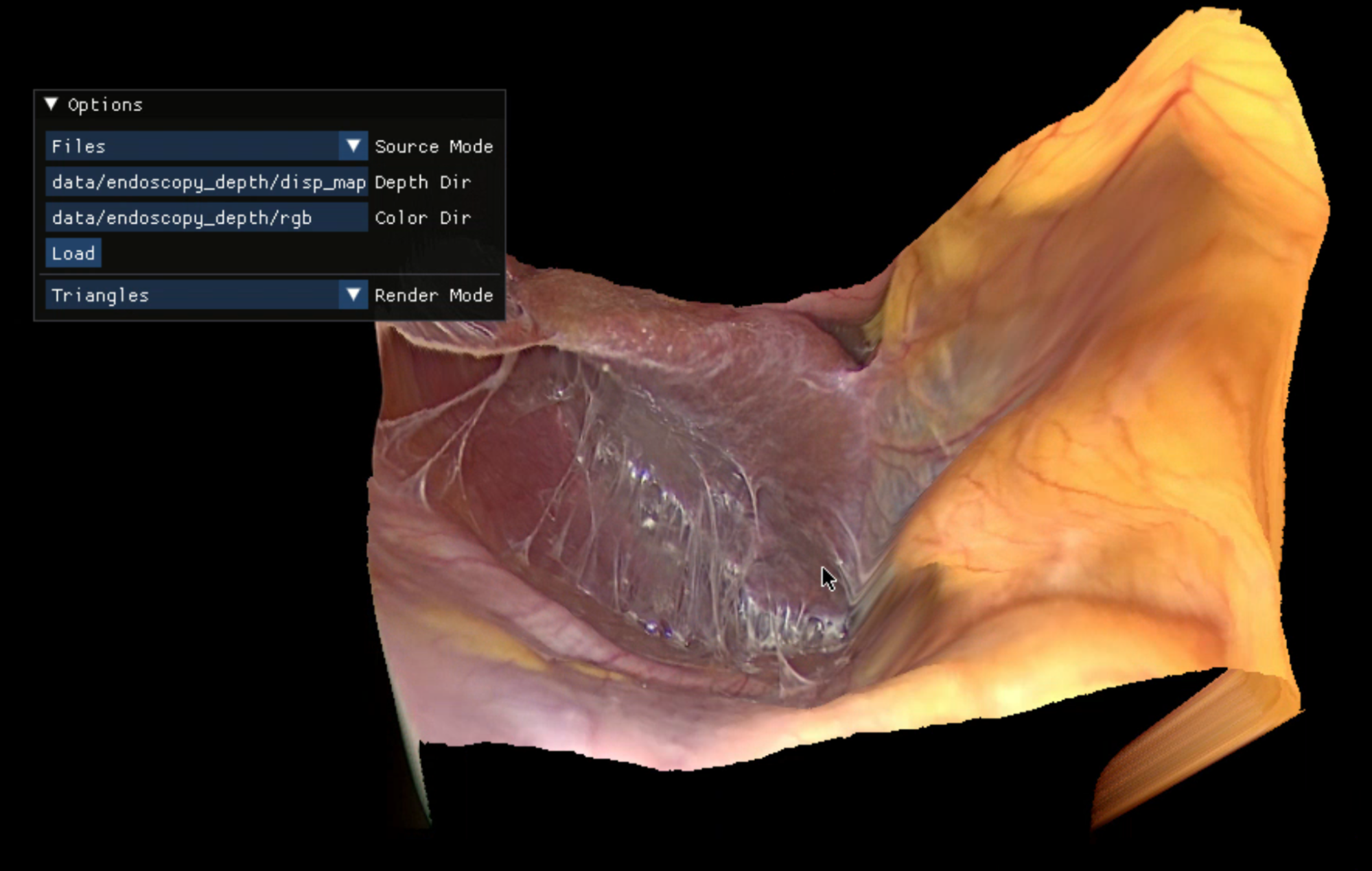 Screenshot shows endoscopy rendering with new depth map.