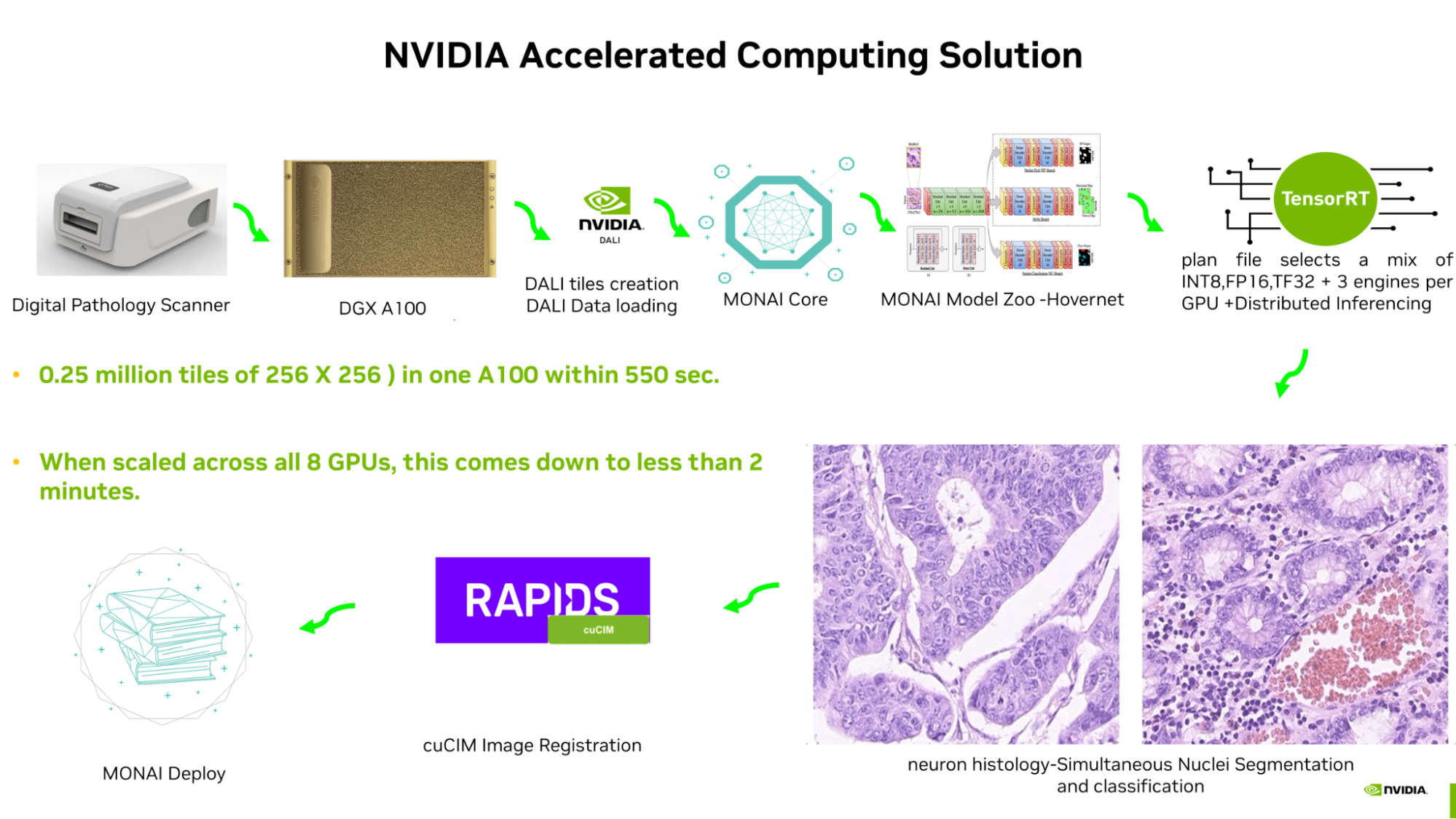 Diagram shows different stages of the NVIDIA accelerated computing workflow for medical imaging, from digital pathology scanner to MONAI Deploy.
