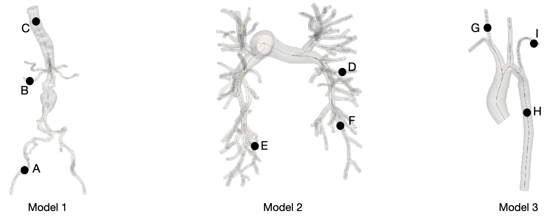 Model 1 shows aortofemoral model affected by an aneurysm. Model 2 shows a healthy pulmonary model. Model 3 shows an aorta model affected by coarctation.