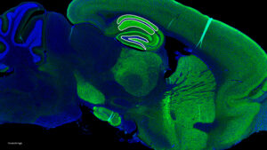 Decorative image of stained cells in light green on dark blue background.