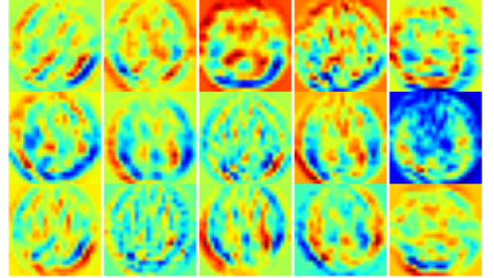 Example of CNN for brain scan results.