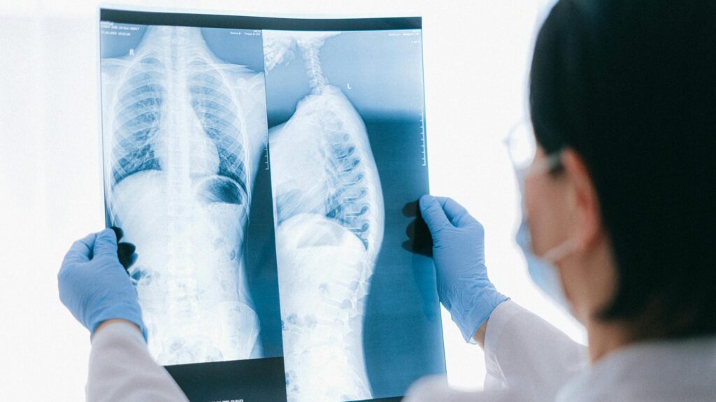 A woman doctor holding up two spinal X-rays.